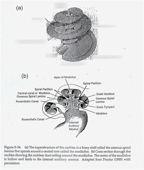 Image result for Modiolus Cochlea