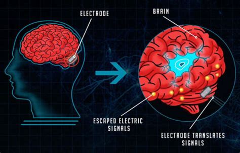The Evolution Of Brain-Computer Interfaces - WordlessTech
