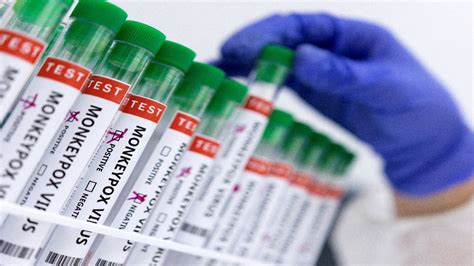 US declares public health emergency over monkeypox outbreak