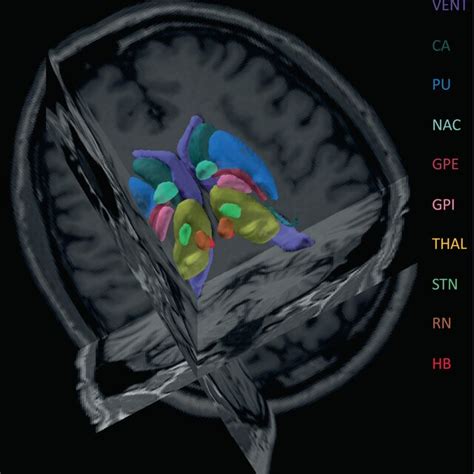 Image result for Decathlon Brain Segmentation Code
