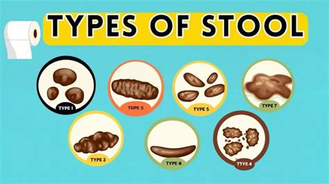 Poop Stool 的图像结果