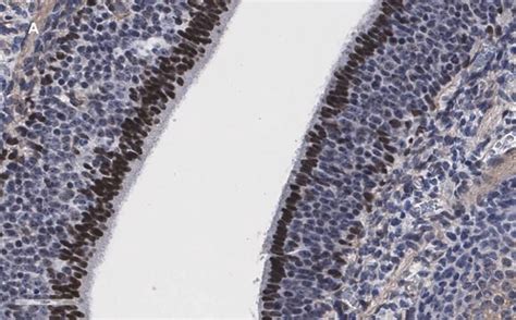 抗Sox2抗体 クローン1A2 ZooMAb®ウサギモノクローナル recombinant, expressed in HEK 293 ...