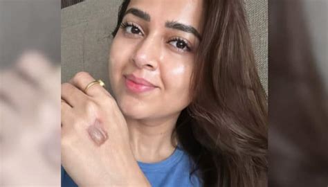 Tejasswi Prakash Suffers Burn Injury On 'Celebrity MasterChef' Set