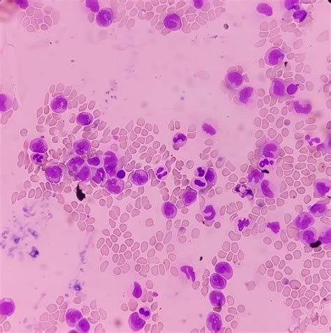 Expert Perspectives | Ian W. Flinn - Expert Perspectives