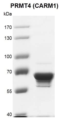 Recombinant PRMT4 (CARM1) protein | Proteintech