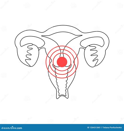 Vector Isolated Illustration of Uterus with Pain Stock Vector - Illustration of object, logo ...