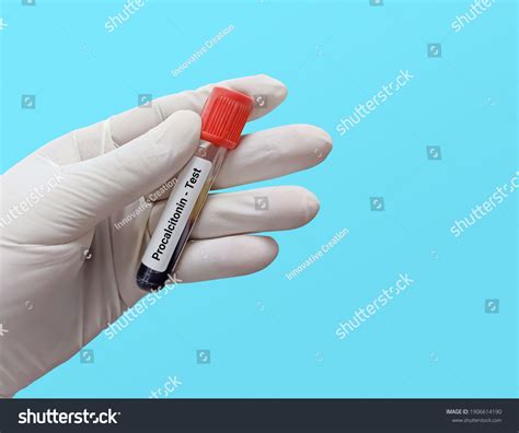 PCT Sample Test 的图像结果