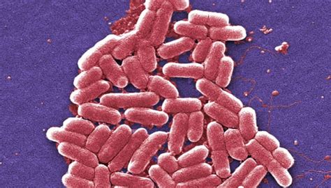 Superbug NDM-1: What you need to know, why it's so dangerous! | Health ...