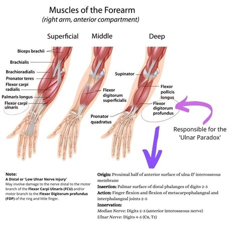 Forearm Muscle Strain
