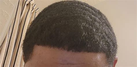 Messed Up Hair Lines