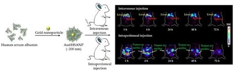 Image result for Intraperitoneal Injection in Humans Needle