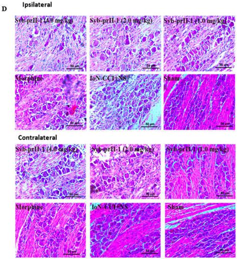 Scorpion Neurotoxin Syb-prII-1 Exerts Analgesic Effect through Nav1.8 ...