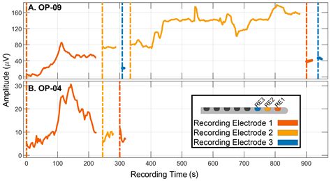 Evaluation of Real-Time Intracochlear Electrocochleography for Guiding ...