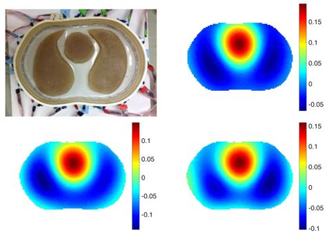 Calderón’s Method with a Spatial Prior for 2-D EIT Imaging of ...