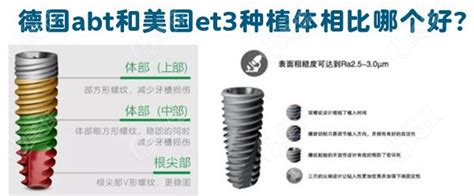 同样为纯钛材质的以色列雅植ABT种植系统,质量好不好呢 - 口腔资讯 - 牙齿矫正网