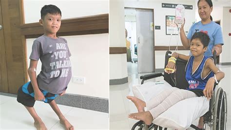 Tebow CURE Hospital corrects boy's leg deformity | FOX 26 Houston