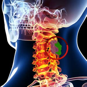 Neuro Surgery | St. Theresa's Multi Speciality Hospital