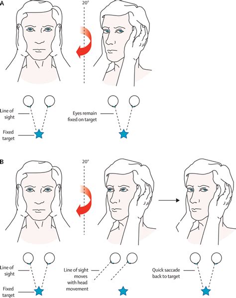 Image result for Vor Test Questions