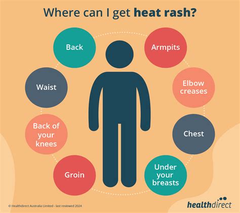 Heat Rash Chest