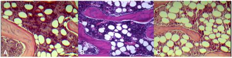 Organic Nitrate Maintains Bone Marrow Blood Perfusion in Ovariectomized ...
