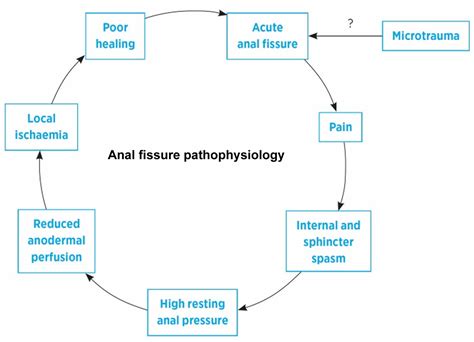 Anal fissure, causes, signs, symptoms, diagnosis & treatment