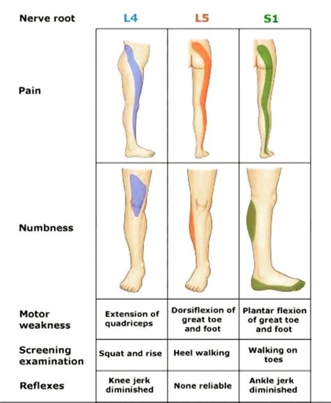 Nerve Root demonstration L4, L5, S1..... | Dr. Waqar Mukhtar