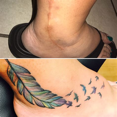 Scar cover up! | Tattoos to cover scars, Scars tattoo cover up, Tattoo ...