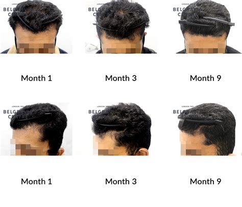Hair Growth Black Male at Isabel Begg blog