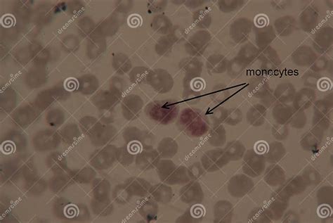 Image result for Monocyte Under Microscope