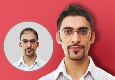 Renowned Hair Transplant | Hair Regrowth Clinic | Advanced GroHair