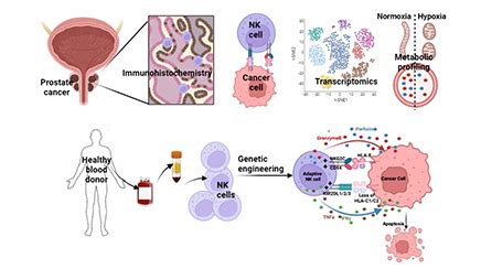 Characterization of Natural Killer cells in Prostate Cancer and ...