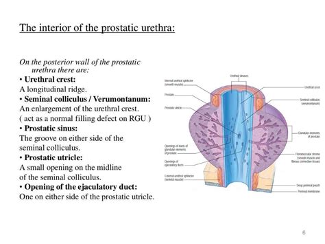 Image result for Retrograde Urethrogram RadioGraphics