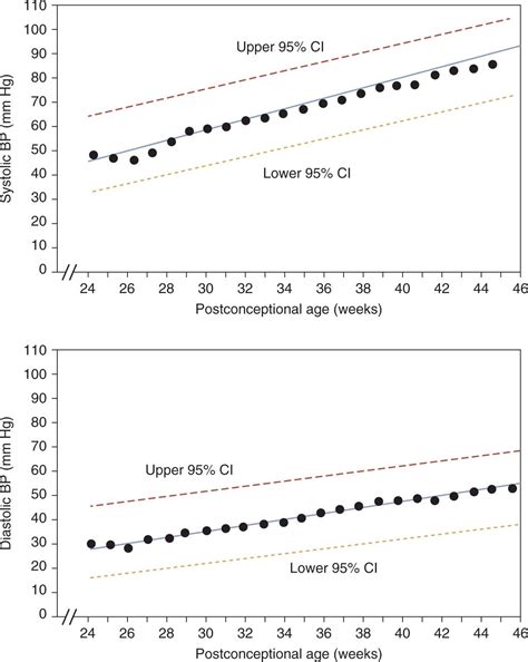 Neonatal Hypertension | Obgyn Key