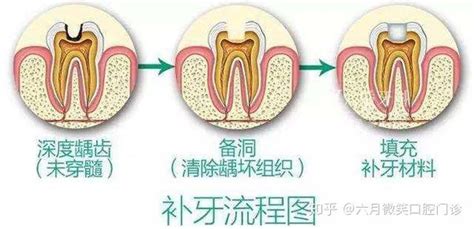 【晚上磨牙怎么办】【图】晚上磨牙怎么办 介绍应对晚上磨牙的治疗方法(2)_伊秀健康|yxlady.com