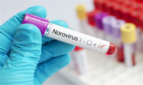 Norovirus: All About the Virus Reported in Kerala