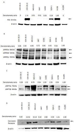 Pramlintide: A Novel Therapeutic Approach for Osteosarcoma through ...