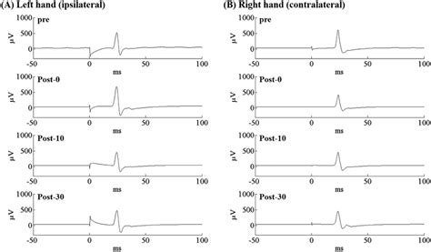 MEPS 的图像结果