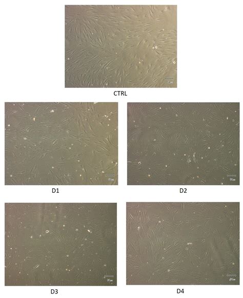 Effect of Different Titanium Dental Implant Surfaces on Human Adipose ...