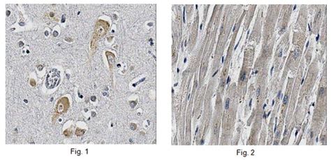 Anti-DENR Antibody, clone 10D9.1 | MABN226