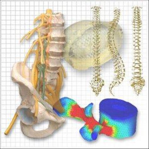 Spring Testing Spine 的图像结果