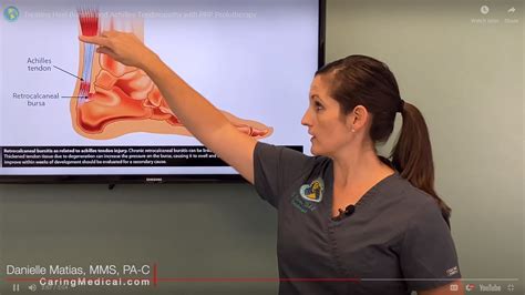 Retrocalcaneal (heel) bursitis - Non-Surgical treatments