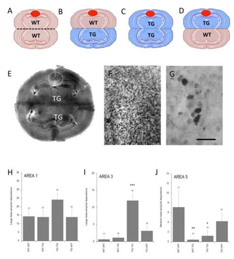 Spreading of Beta-Amyloid in Organotypic Mouse Brain Slices and ...