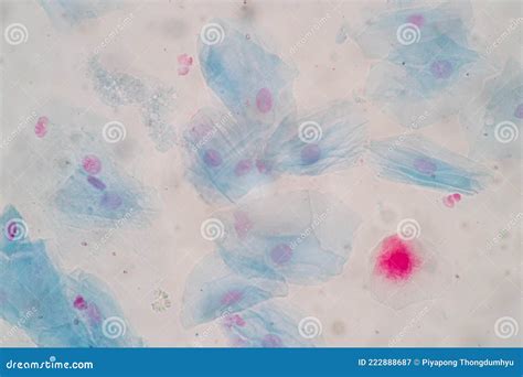Histological Sample Squamous Epithelial Cells Under Microscope. Stock ...