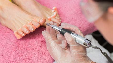 Image result for How to Remove Calluses From Feet Fast