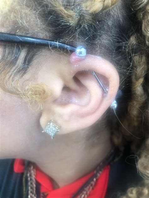 Idk what this is. is this a piercing bump or a keloid. If it’s not a keloid what can I do to ...