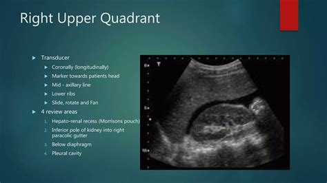 E-Fast Examination | PPTX