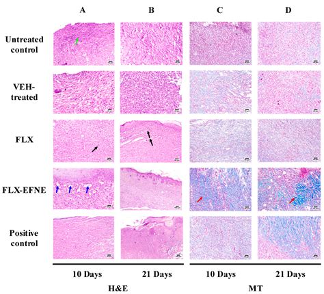 RETRACTED: Fluoxetine Ecofriendly Nanoemulsion Enhances Wound Healing ...