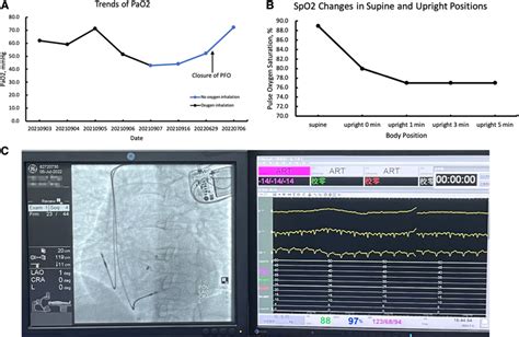 Image result for PaO2 SpO2