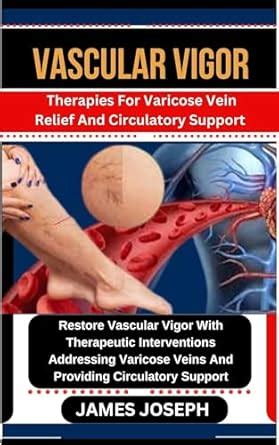 VASCULAR VIGOR: Therapies For Varicose Vein Relief And Circulatory ...