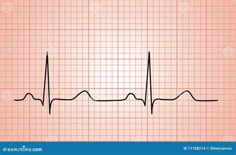 Heartbeat Normal ECG graph stock illustration. Illustration of muscular - 71108214